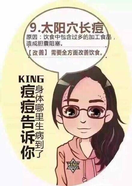 脸上痘痘分布说明身体什么问题,专家讲解痘痘经验