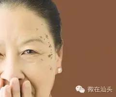 一图读懂什么样的痣易癌变,点痣后增生了肉痣会变癌吗