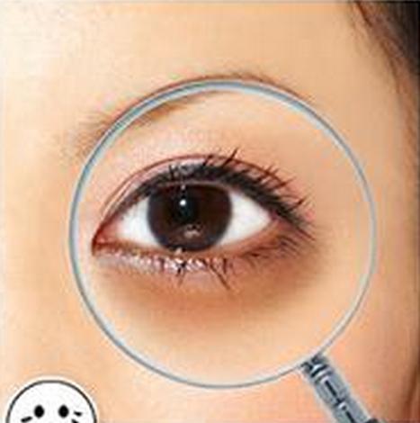 眼袋太重怎么办找对方法很重要,常年熬夜又喝水多有眼袋怎么办