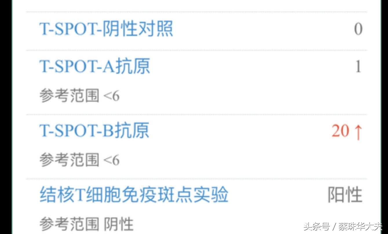 乙肝肺结核会不会导致胎停,胎停为什么查乙肝病毒