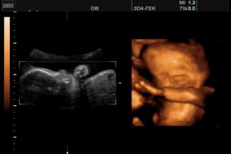 胎儿在肚子里发育的全过程照片,胎儿在肚子里的成长过程图片