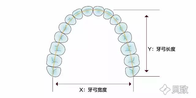 牙齿矫正是拔牙多好还是少好,为什么牙齿矫正一般都要拔牙