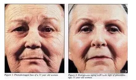 撑起一份优雅，防止晒成古天乐