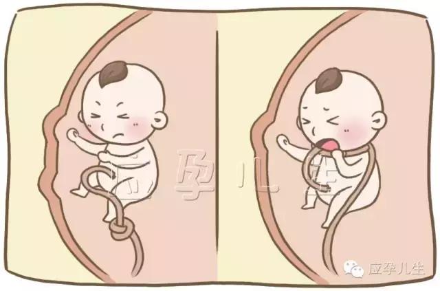 怎么样的胎动说明胎儿舒服,什么样的胎动说明胎位是正的