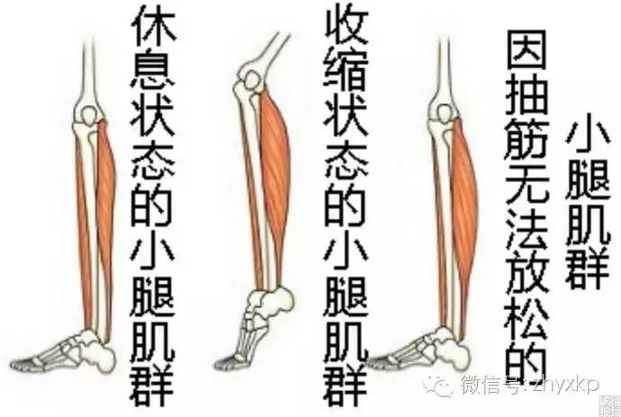 动不动就抽筋肝不好,动不动就要抽筋