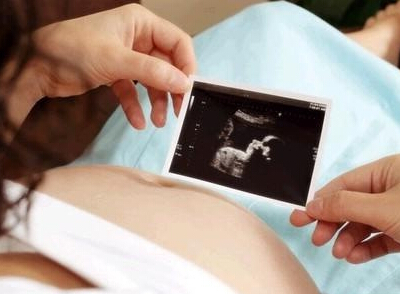 胎停育再次怀孕注意事项,胎停育准妈妈要避免这些事别疏忽