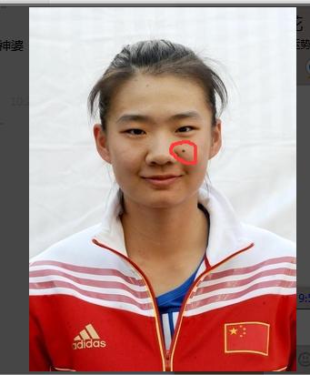 奥运会中那些面相+痣的分类代表了什么含义？冠军or脑残！