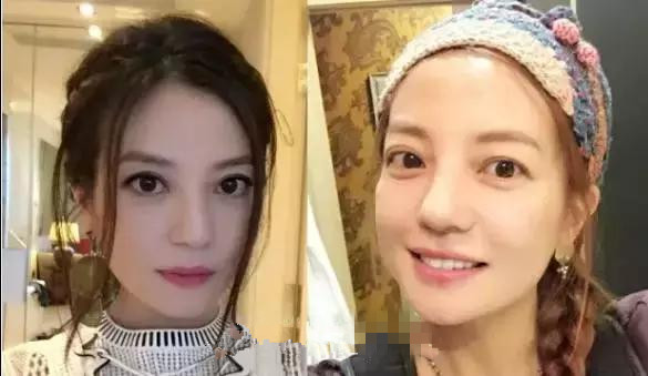 圆脸也可以中分,大圆脸侧分中分哪个瘦脸