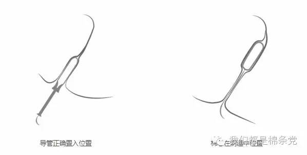 月经期用棉条下水安全么,用月经棉条就可以潜水么