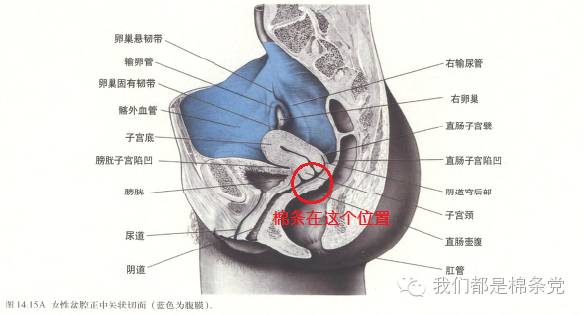 月经期用棉条下水安全么,用月经棉条就可以潜水么