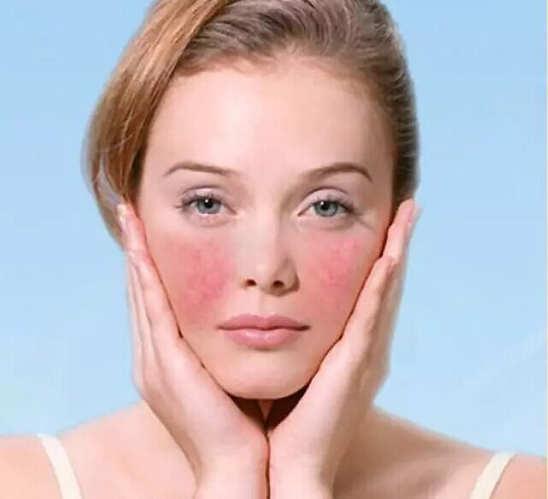 纪旺西治疗激素脸怎么样,化妆品激素脸怎么治疗