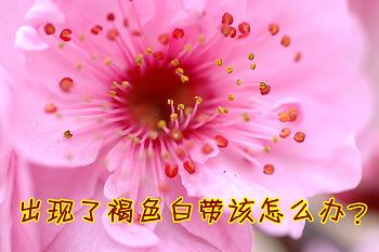 手把手教你看懂白带化验单！