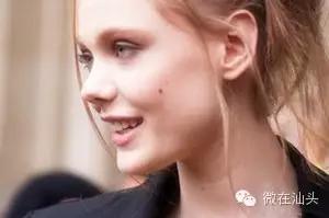 一图读懂什么样的痣易癌变,点痣后增生了肉痣会变癌吗