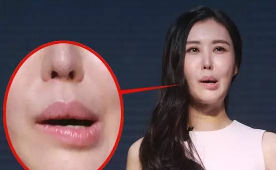 嘴歪眼歪是怎么引起的,嘴歪斜的可能原因是什么