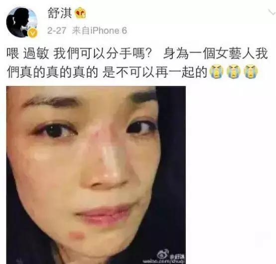 名医专访,专家医生谈敏感肌肤