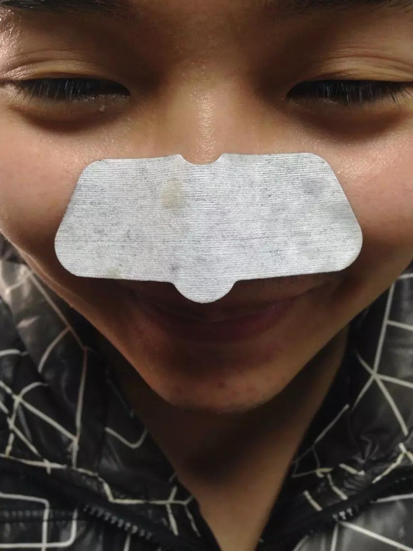 手把手教你有效去黑头的方法,手把手祛黑头