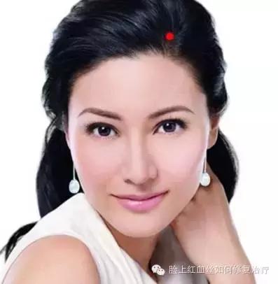 脸颊有红血丝怎么办才能有所改善,脸颊红血丝如何改善