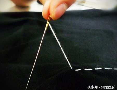 缝衣针扎了没出血会破伤风吗,缝针感染破伤风的概率