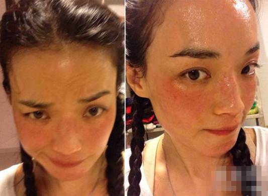 名医专访,专家医生谈敏感肌肤