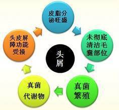 为什么你的头屑越洗越多,头屑该怎么彻底去除