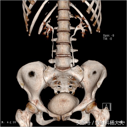 花季少女腰疼是什么原因,青春期女生为什么总是腿痛