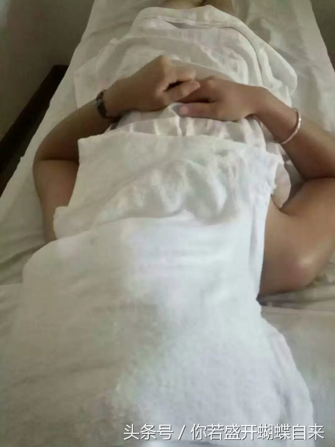 中医理疗火疗,中医的火疗是什么