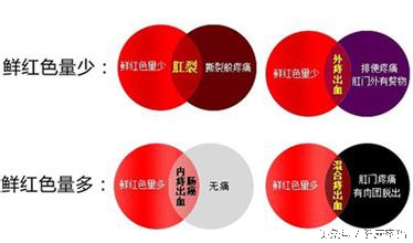 孕16周大出血一次不出了,孕妇怀孕六个月有点出血是怎么了