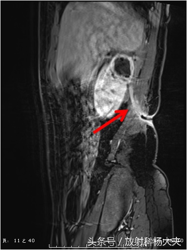 花季少女腰疼是什么原因,青春期女生为什么总是腿痛