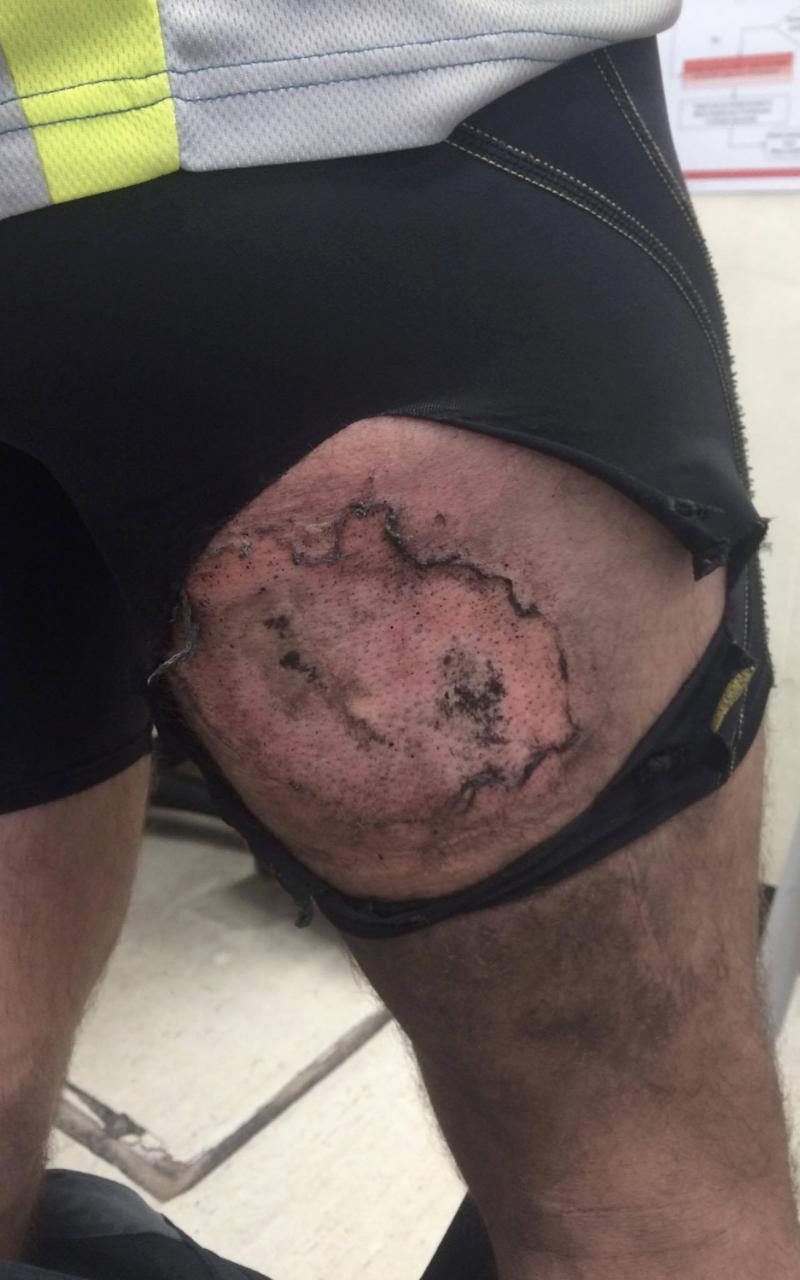 手机爆炸了手机厂商要负责吗,手机爆炸了要找商家赔偿吗