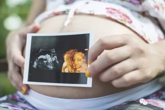 准妈妈要当心孕期最易犯的小错误,孕检四大误区小心别踩雷