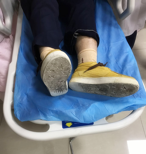 80岁主动脉夹层自愈真实案例,关于主动脉夹层的小故事