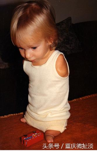 他没手没脚，却可以玩骑马、打鼓、潜水、足球，有两个大学学位。