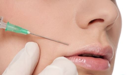 法令纹这么显老得如何搞定,最显老的法令纹解决方法