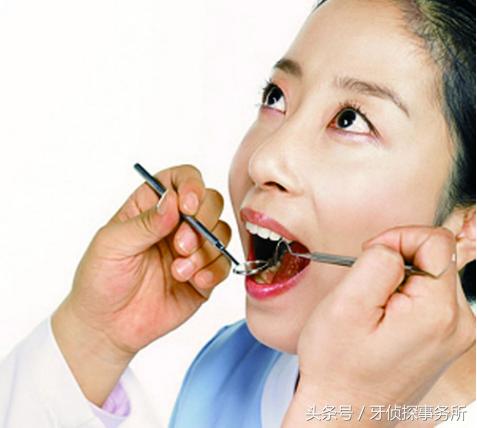 吃肉就塞牙怎么彻底解决,吃肉塞牙有什么好的办法解决