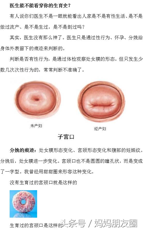 曾经流产、生育过，医生能不能一眼看穿