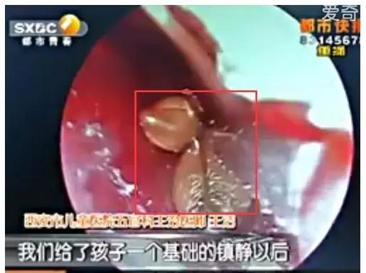 小孩玩沙掉进去烫死了,小孩玩沙