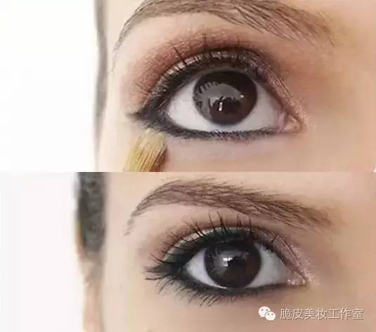 祖传秘方治疗眼睛空洞,祖传秘方治眼睛失明