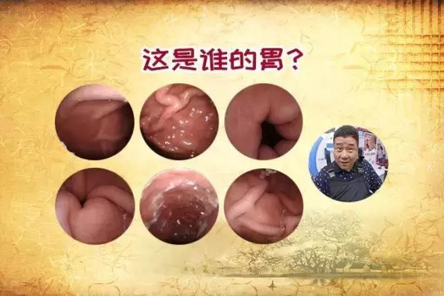 对号入座|事业胃，神经胃，美食胃，金属胃，你是哪种胃？
