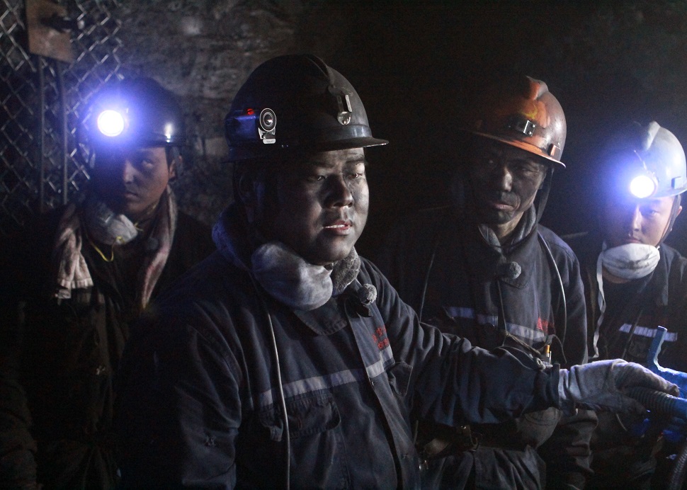 皮肤黑不是问题，黑到只看得见牙齿就是你的错了