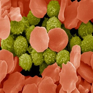 什么疾病如此难以确诊？