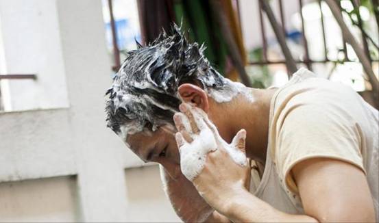 额头头皮屑多怎么回事,男士头皮屑多怎么回事