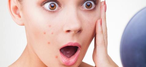 马上要长痘痘了怎么急救,长痘痘该注意的事情