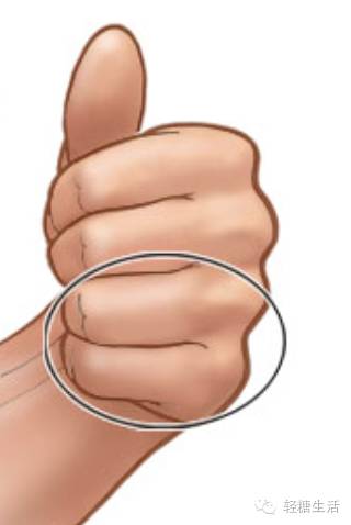 针对糖尿病人的膳食指南包括,糖尿病饮食指南食谱量表