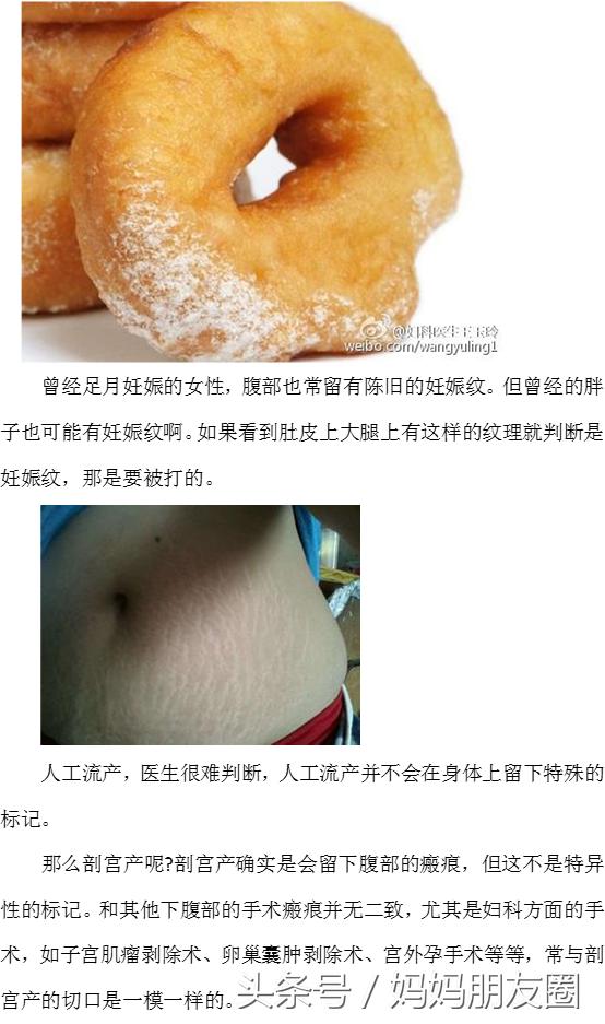 曾经流产、生育过，医生能不能一眼看穿