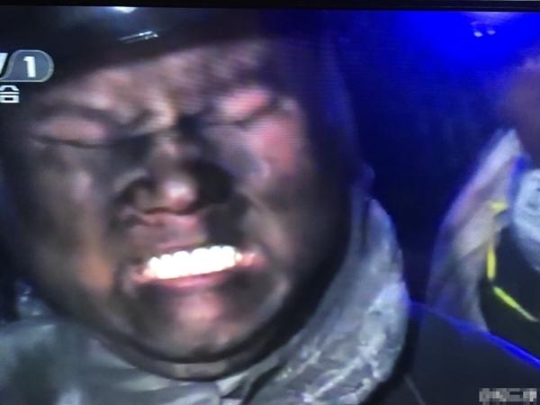 皮肤黑不是问题，黑到只看得见牙齿就是你的错了