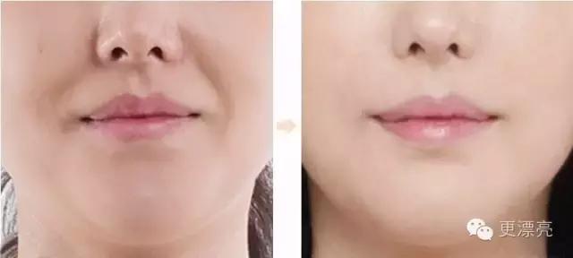 爱笑的女孩法令纹都很深,爱笑的女孩法令纹都不会太差