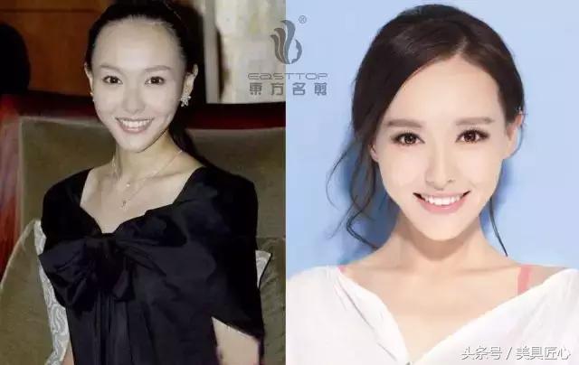 颜值不够齐刘海来凑,没有刘海都很好看