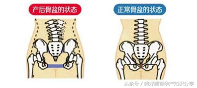 剖腹产后收腹带一般弄好久,美好蕴育哺乳期能吃吗