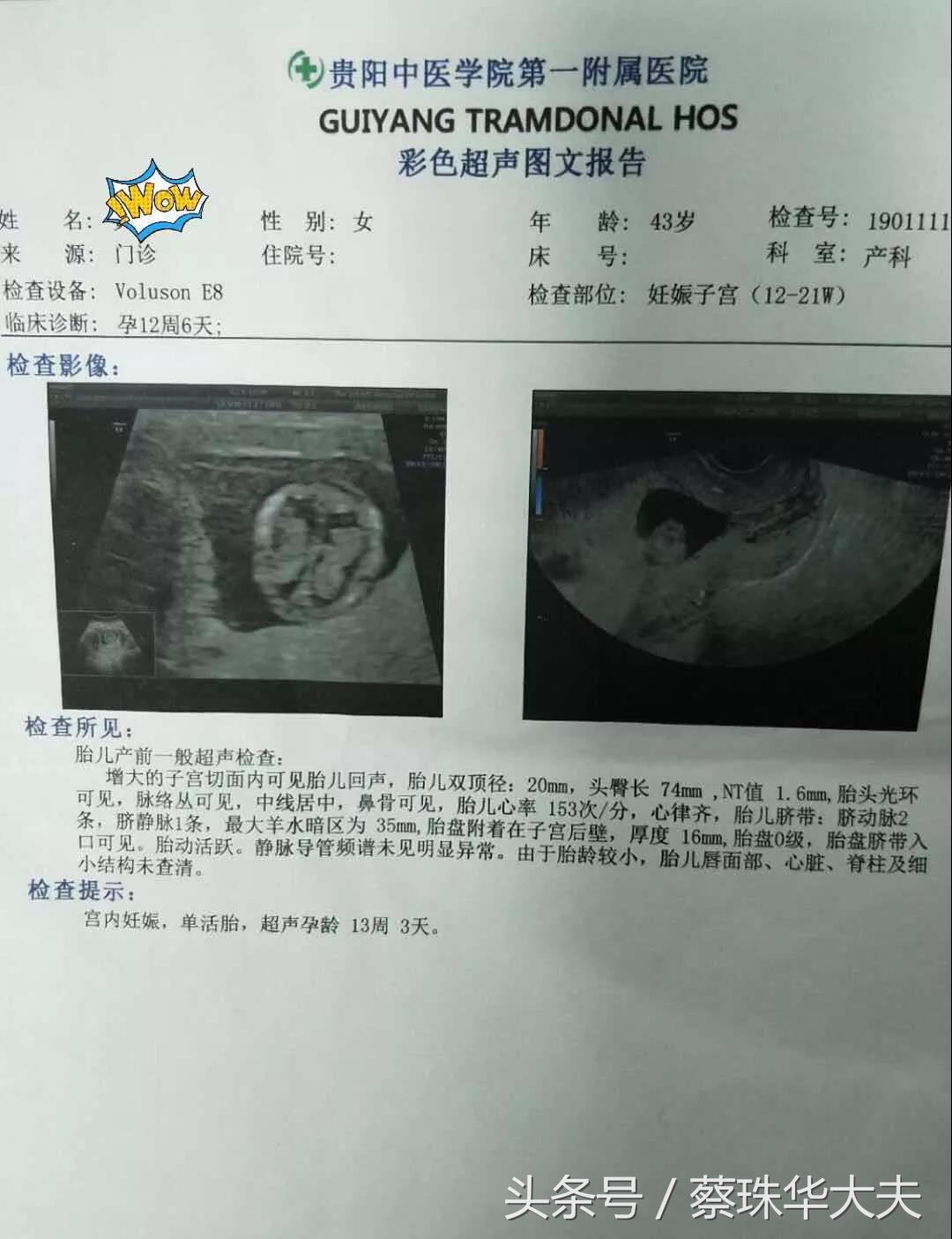 孕妈将很轻松的度过哺乳期,孕妈过了预产期怎么办