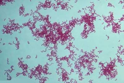 益生菌对水产养殖真的有用吗,水产养殖消毒后多久才能培藻